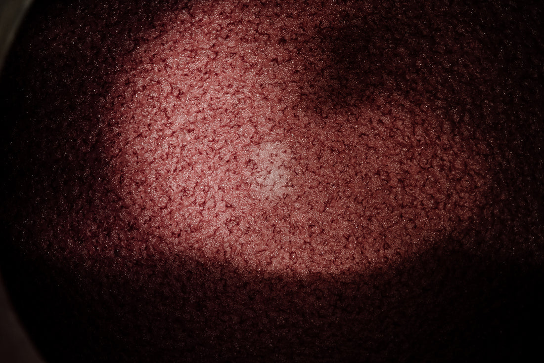 Brettanomyces : Moyens de diagnostic et de contrôle du développement dans les vins